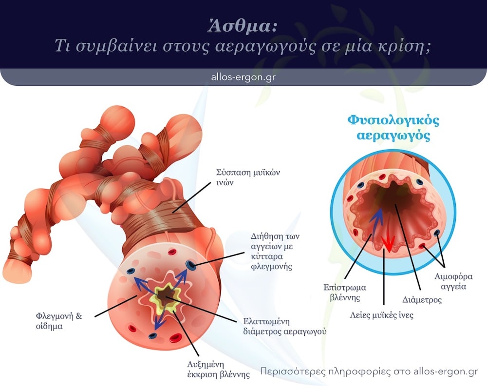 Μεταβολές στους αεραγωγούς σε ασθενείς με άσθμα