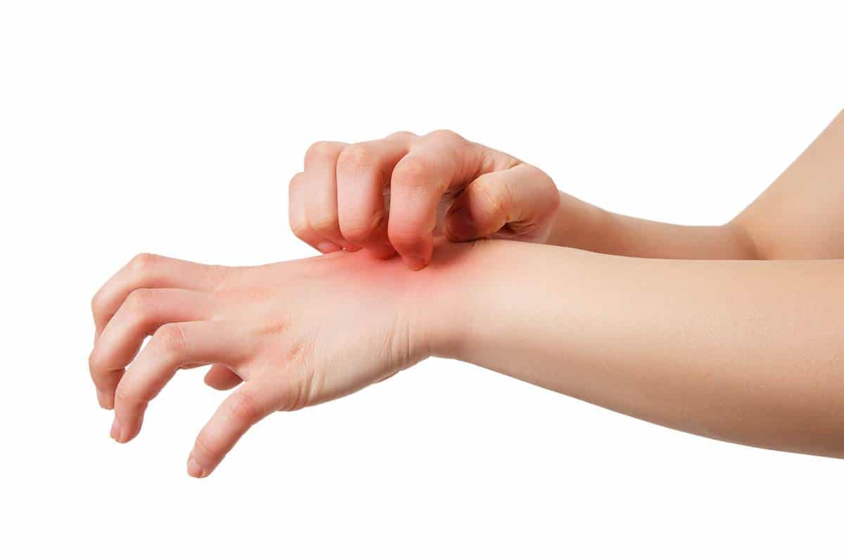 Κνησμός στα χέρια