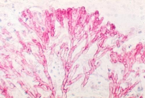 Εικόνα 1: Υφές του Aspergillus fumigatus flickr photo by Microbe World  shared under a Creative Commons (BY-NC-SA) license.