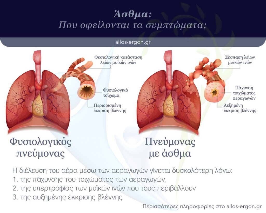 που οφείλονται τα συμπτώματα του άσθματος 